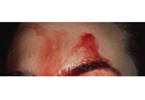 Sédhiou: Le directeur de l’hôpital se tranche la gorge Sédhiou: Le directeur de l’hôpital se tranche la gorge