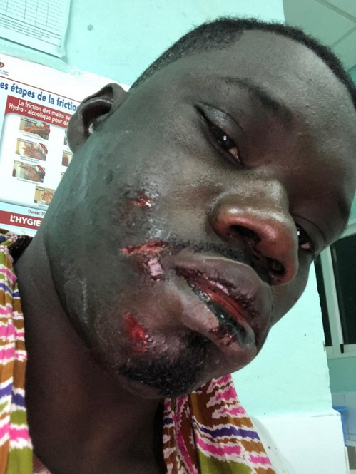 Dernière minute: Guin Thieuss sauvagement agressé...