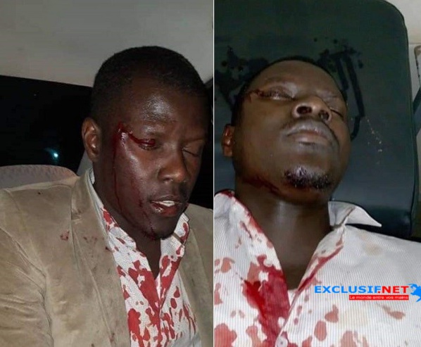 Les nervis de Macky Sall agressent des responsables de Pastef à Saint Louis Les nervis de Macky Sall agressent des responsables de Pastef à Saint Louis