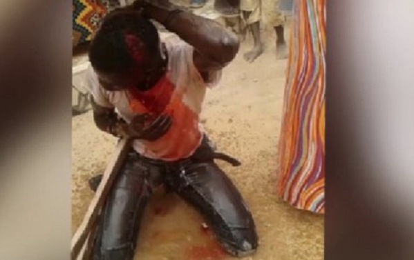 DAKAR : Un supposé voleur lynché à mort