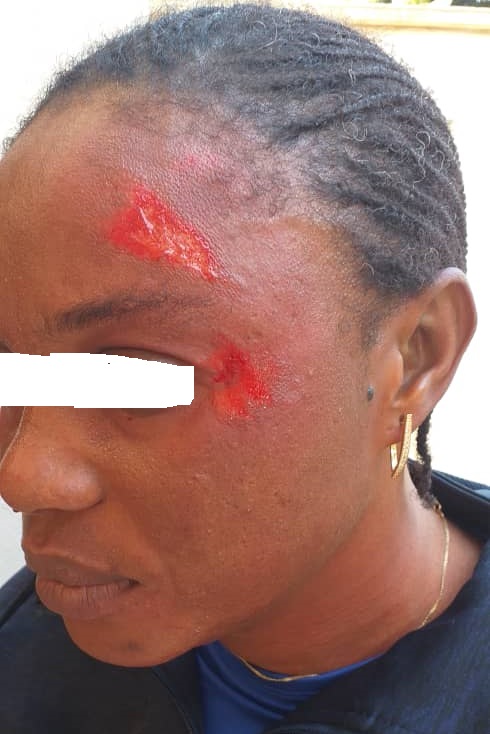 Lycée Blaise Diagne de Dakar: une élève agresse son professeur d’EPS et la défigure... les cours suspendus