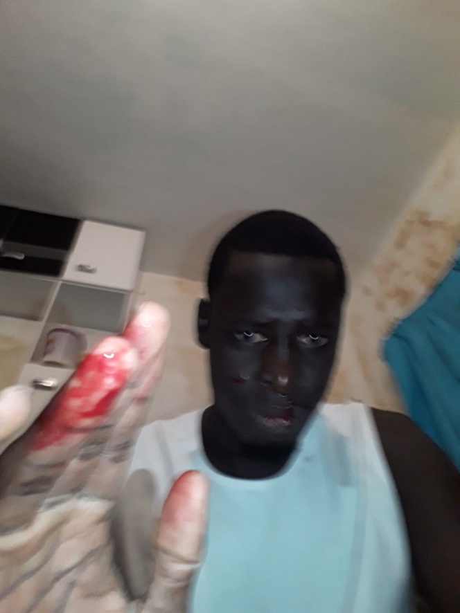 Brésil: Un Sénégalais filme sa tentative d'assassinat...