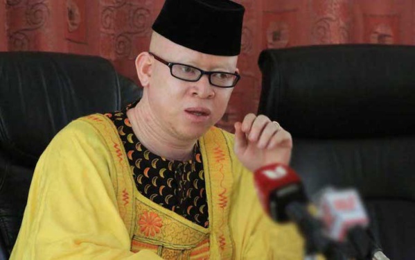 Isaac Mwaura premier député kenyan albinos veut faire changer les mentalités Isaac Mwaura premier député kenyan albinos veut faire changer les mentalités