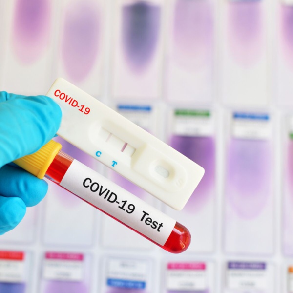 Covid-19 : Le Sénégal déploie le test rapide à 1000 Fcfa Covid-19 : Le Sénégal déploie le test rapide à 1000 Fcfa