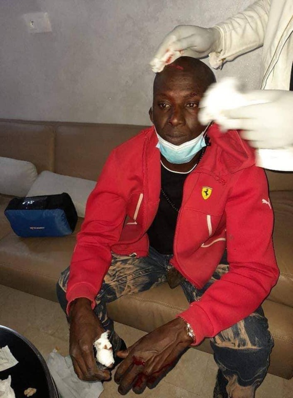 Affrontements chez Sonko : Assane Diouf gravement Blessé