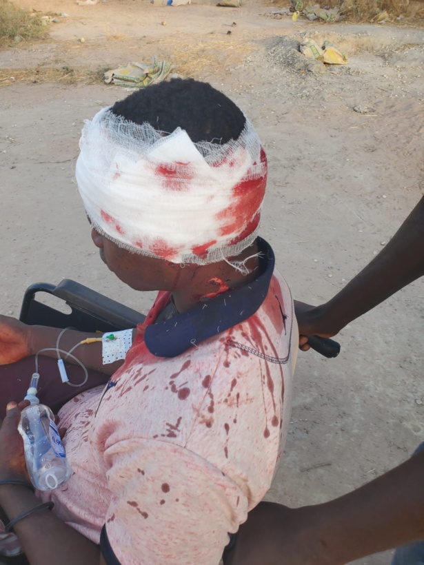 Violences préélectorales : Plusieurs militants de "Défar Sa Gokh" blessés par...