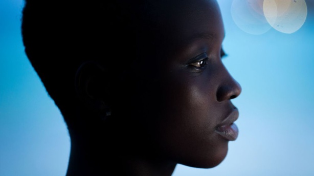 Afrique, les dangers du blanchiment de la peau Afrique, les dangers du blanchiment de la peau