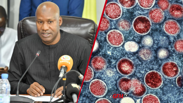 Variole du singe : Le Sénégal renforce sa surveillance épidémiologique Variole du singe : Le Sénégal renforce sa surveillance épidémiologique