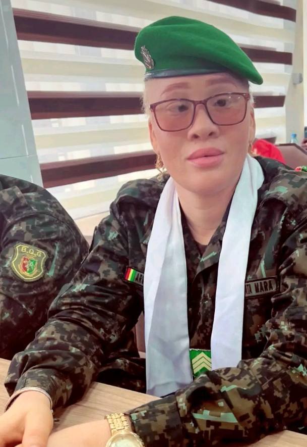 Fatoumata Mara : « L’albinisme, une force, pas une faiblesse » Fatoumata Mara : « L’albinisme, une force, pas une faiblesse »