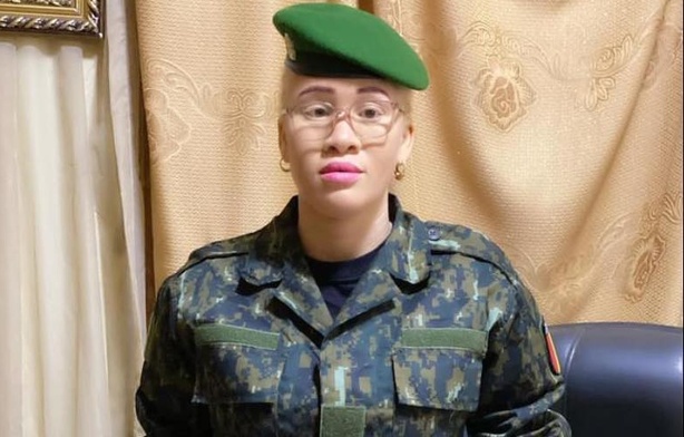 Fatoumata Mara : « L’albinisme, une force, pas une faiblesse » Fatoumata Mara : « L’albinisme, une force, pas une faiblesse »