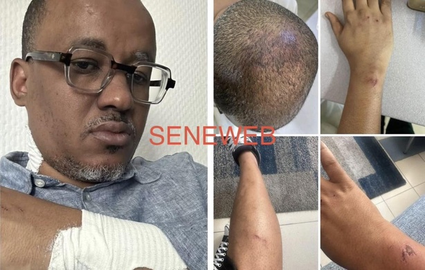 Violences présumées au tribunal de Pikine : Oumar Sow saisit le Doyen des juges