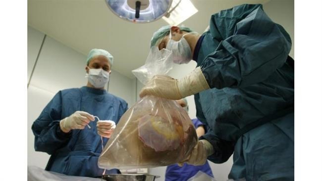 Comment les Jihadistes de Daech vendent les organes de ses prisonniers en Israel