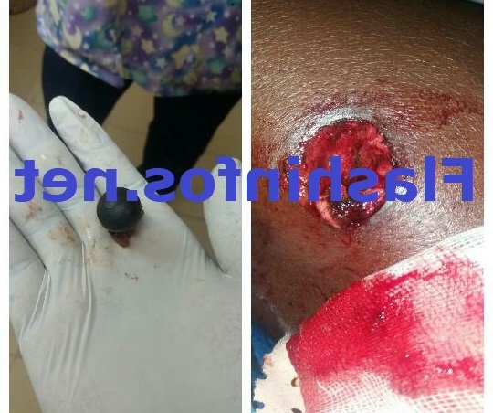 Manifestions à Ziguinchor: une militante du PDS blessée par une balle réelle