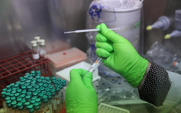 Sida : des chercheurs sont parvenus à éliminer le VIH de cellules infectées