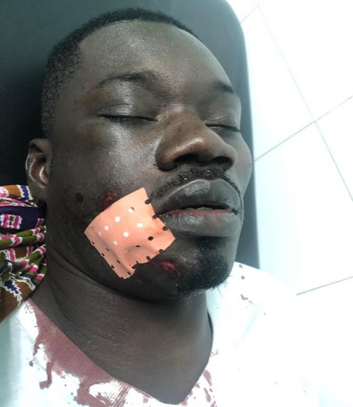 Dernière minute: Guin Thieuss sauvagement agressé...