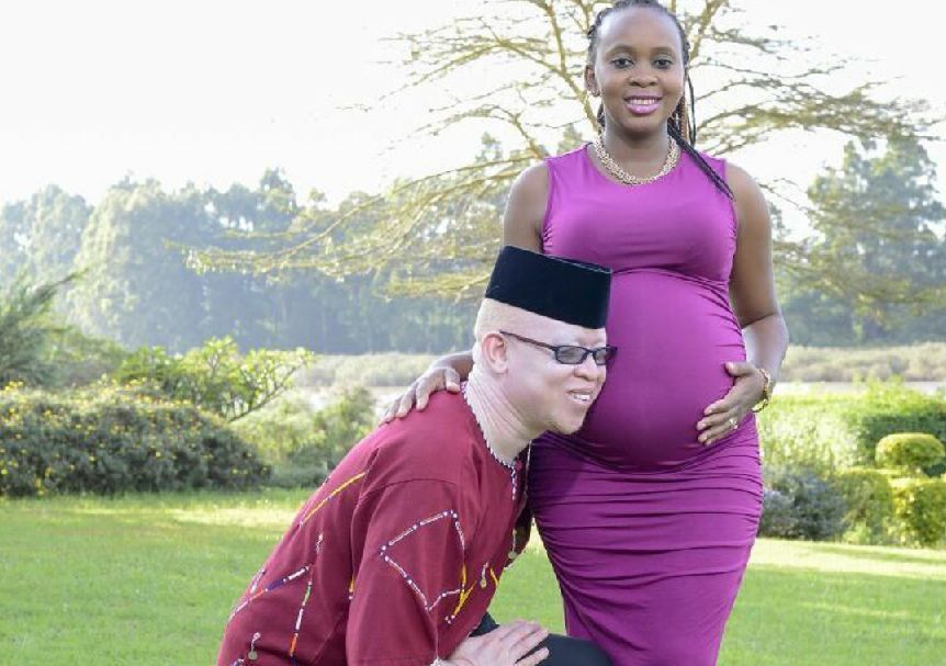 Isaac Mwaura premier député kenyan albinos veut faire changer les mentalités