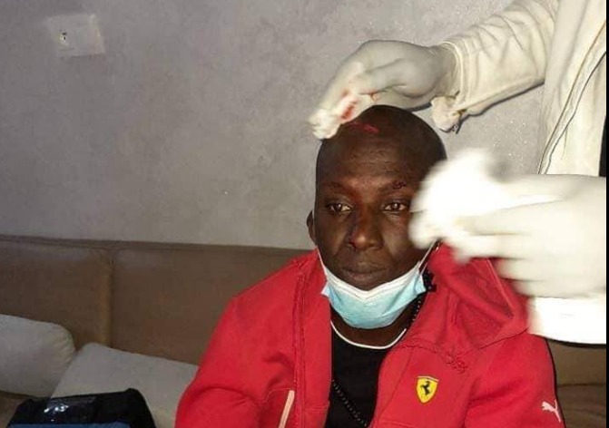 Affrontements chez Sonko : Assane Diouf gravement Blessé