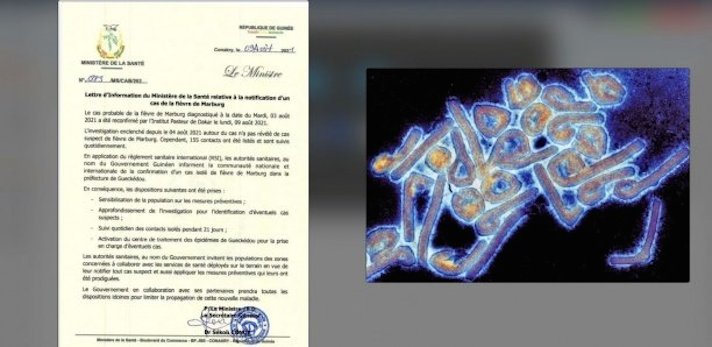 Guinée : Après Ebola, la fièvre "Marburg" fait son apparition 