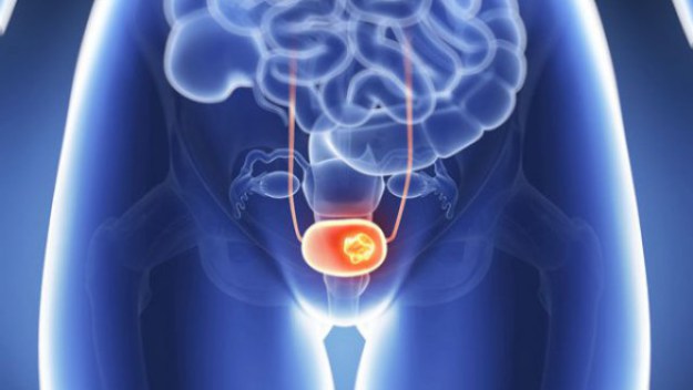 Combien d’éjaculations par mois pour diminuer les risques de cancer de la prostate? La réponse est ici