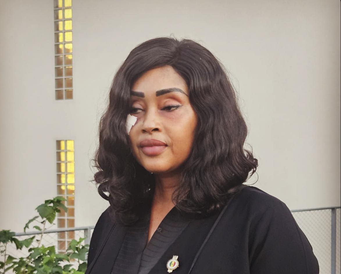 Blessée et en soins à l’étranger, Maimouna Bousso interpelle Diomaye et Sonko
