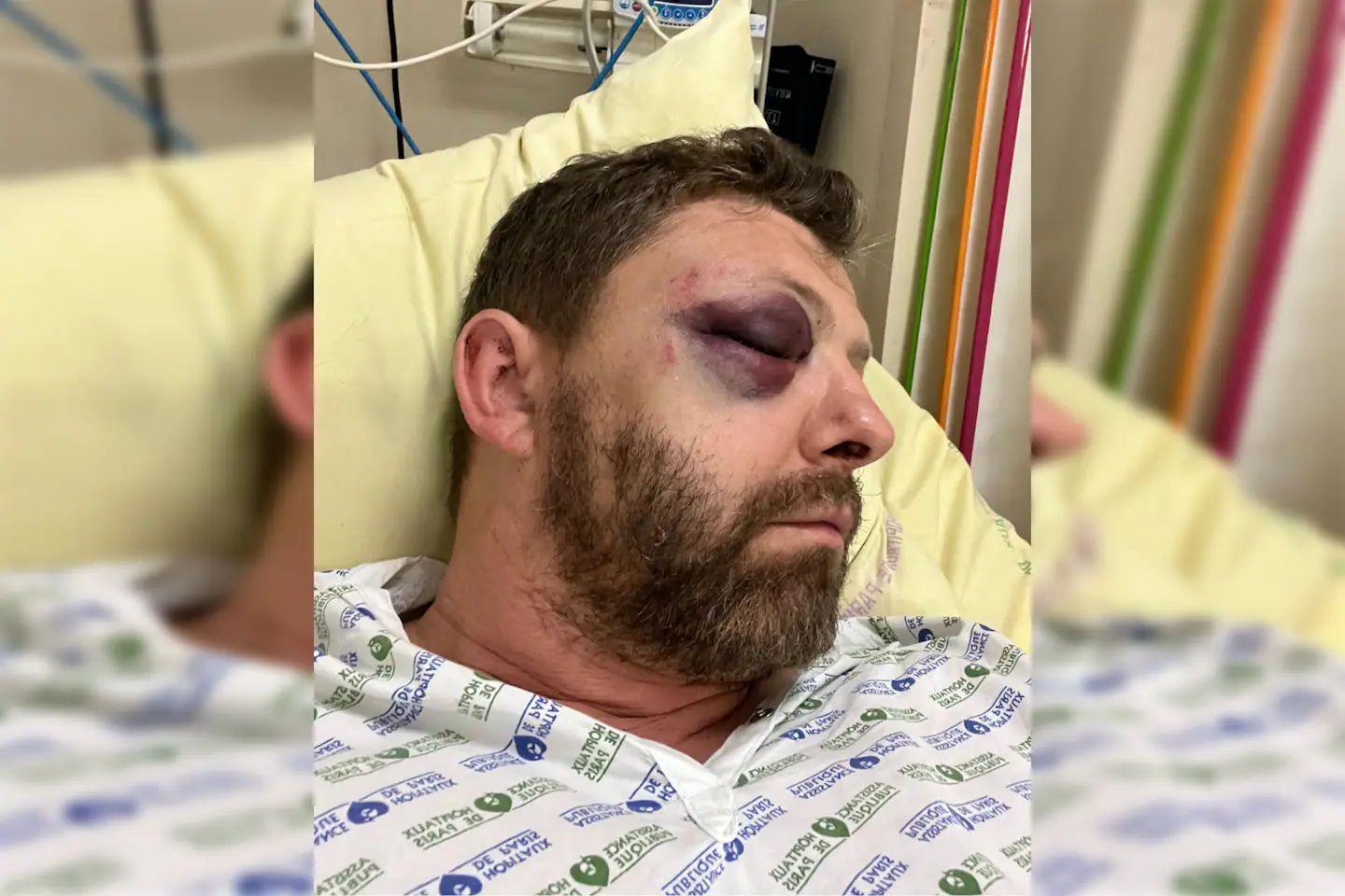 Paris : Le président de l’association LGBT + «FLAG !» victime d’une violente agression