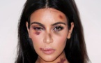 Kim Kardashian attaquée à main armée à Paris