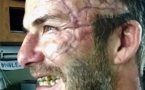 Qu'est-il arrivé à David Beckham?
