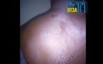 Police de Touba: un commerçant sauvagement torturé par un inspecteur 