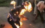 Mbacké : Un jeune de 17 ans s'immole par le feu, après s'être confié à...