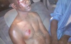 À TOUBA - Un homme lynché par une foule, échappe à la mort. Il était soupçonné de...