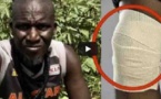 REBEUSS : Assane Diouf sera opéré du genou