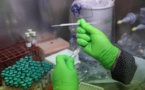 Sida : des chercheurs sont parvenus à éliminer le VIH de cellules infectées
