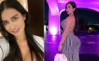 MEXIQUE: Joselyn Cano est morte après une opération des fesses