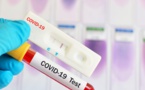 Covid-19 : Le Sénégal déploie le test rapide à 1000 Fcfa