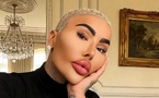 120 000 euros pour ressembler à Kim Kardashian : le destin tragique Jordan James Parke