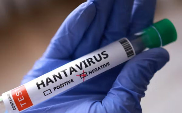 Hantavirus : le ministère de la Santé rassure, aucun cas détecté au Sénégal ni en Afrique