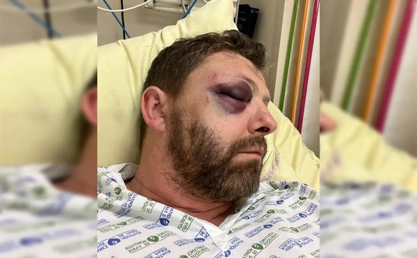 Paris : Le président de l’association LGBT + «FLAG !» victime d’une violente agression