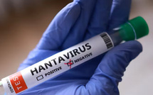 Hantavirus : le ministère de la Santé rassure, aucun cas détecté au Sénégal ni en Afrique