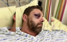 Paris : Le président de l’association LGBT + «FLAG !» victime d’une violente agression