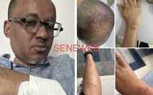 Violences présumées au tribunal de Pikine : Oumar Sow saisit le Doyen des juges